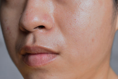 Everything You Need To Know About Oily Skin & Sebum Control