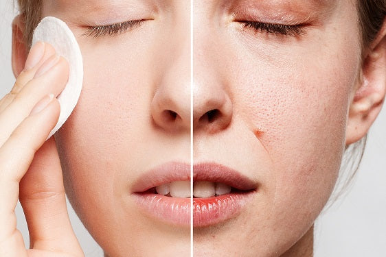 A before and after photo of skin after using a cleanser